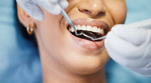Best Emergency Root Canal Therapy in Moultrie, GA