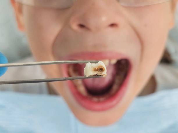 Best Emergency Pediatric Dental Care in Moultrie, GA